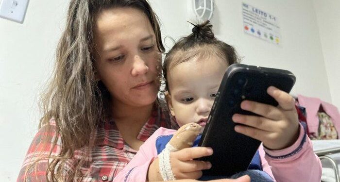 Maceió: Criança sofre queimadura de 3º grau após choque elétrico