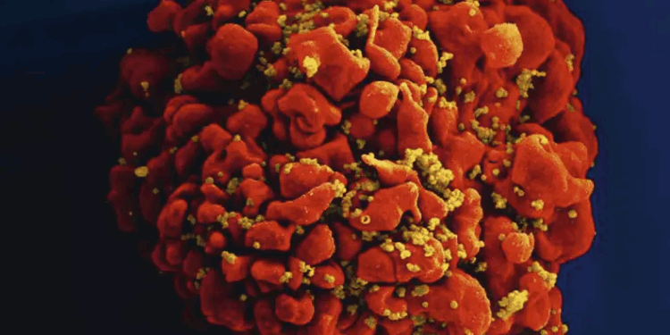 Possível cura: Novo estudo usa RNA mensageiro para tornar o HIV visível ao sistema imunológico