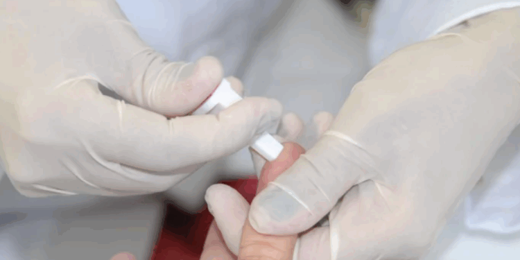 Sesau orienta como prevenir, diagnosticar e tratar as hepatites virais