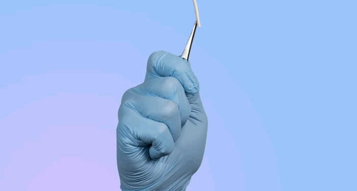 Implante contraceptivo hormonal de longa duração será oferecido no SUS