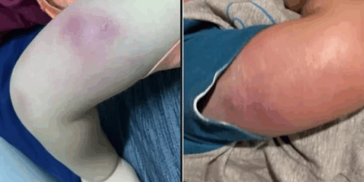 Bebê internado após reação a vacinas recebe alta em Maceió