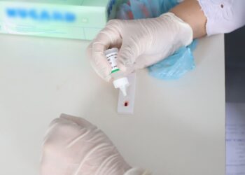 Paciente de SP fica 17 meses curado do HIV com tratamento experimental
