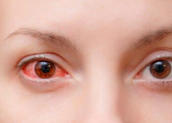 UPAs da parte alta de Maceió registram quase mil casos de conjuntivite