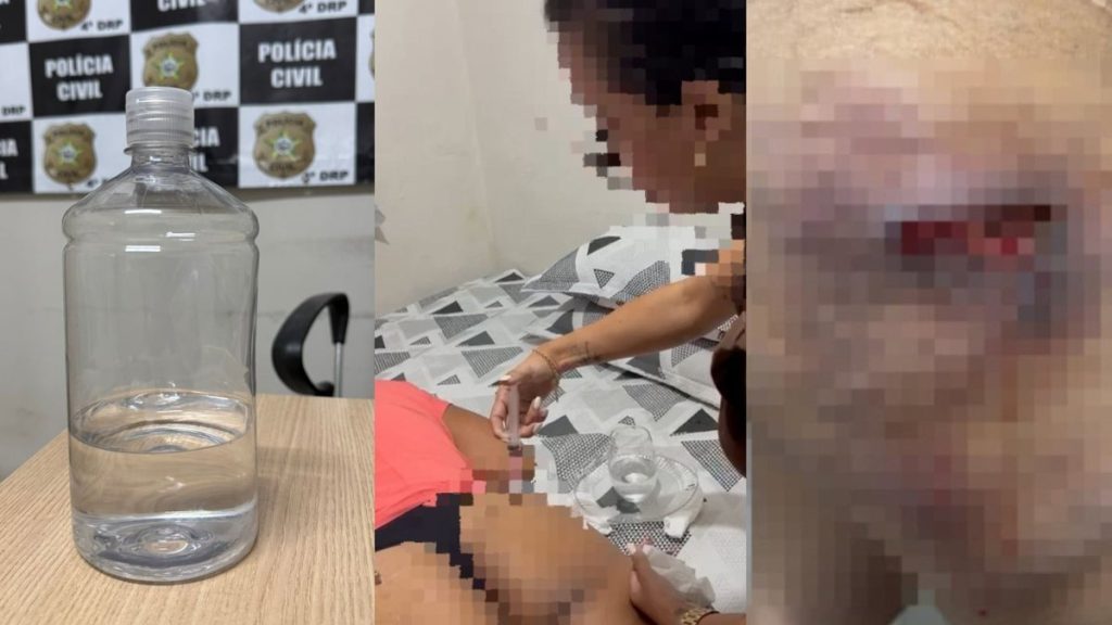 Dentista presa em Alagoas cobrava R$ 2,5 mil por aplicação de silicone industrial