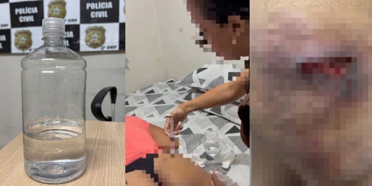 Dentista presa em Alagoas cobrava R$ 2,5 mil por aplicação de silicone industrial