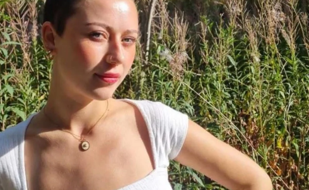 Jovem de 23 anos perde todo o cabelo apos crise de estresse no trabalho