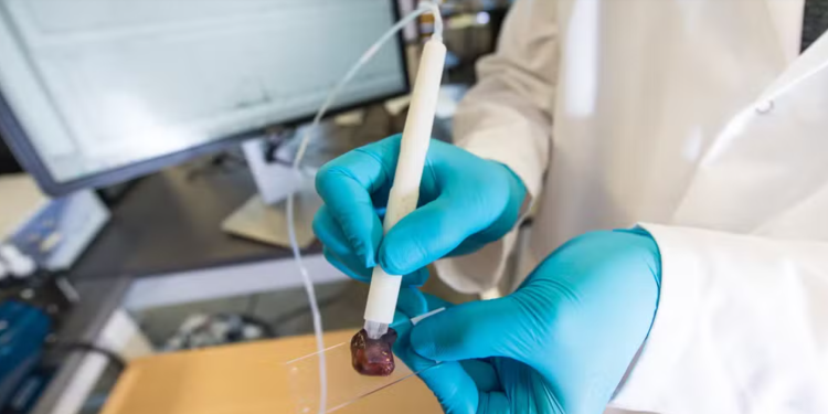 Pesquisadora brasileira cria caneta que detecta câncer em 10 segundos