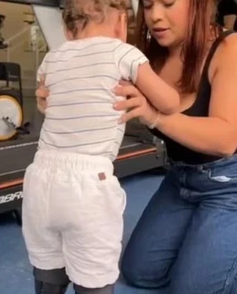 Noah Gabriel dá primeiros passos após superar amputações e fraude do próprio pai