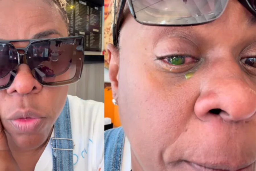 Alerta de Saúde: Pomadas modeladoras de cabelo podem causar lesões oculares graves e cegueira temporal