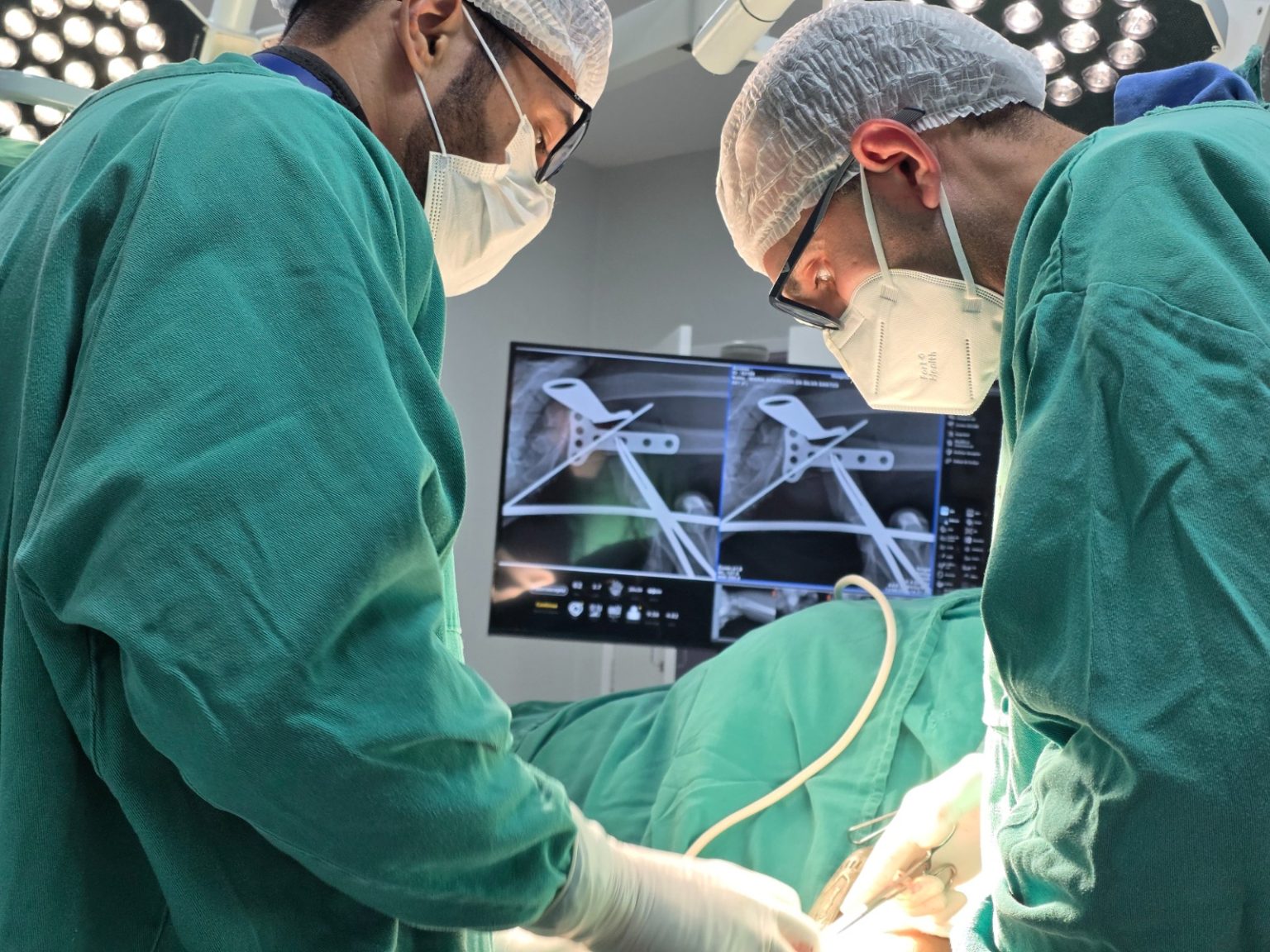 Hospital Regional de Santana realiza cirurgia de fratura de rádio distal e marca avanço na saúde do município